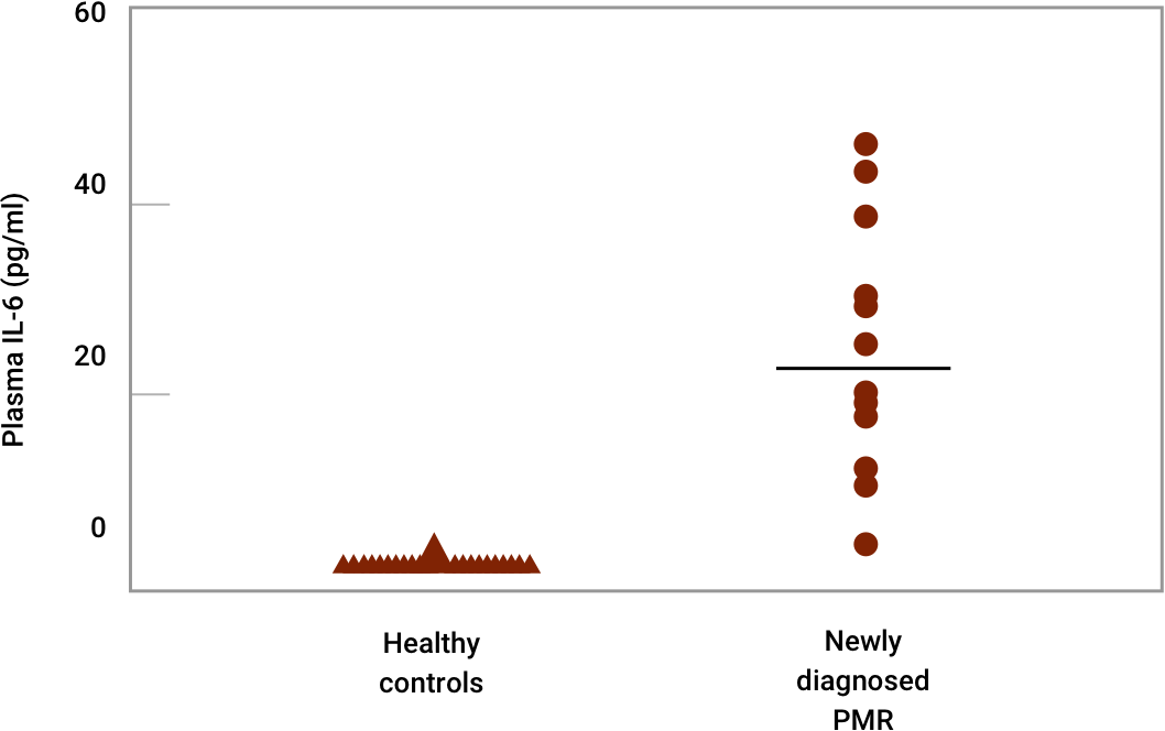 IL-6 and PMR