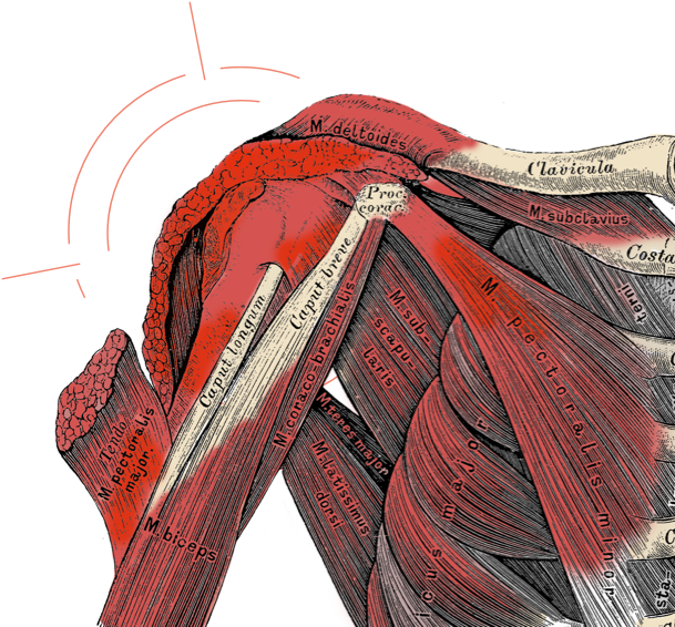 shoulder muscle pain and stiffness